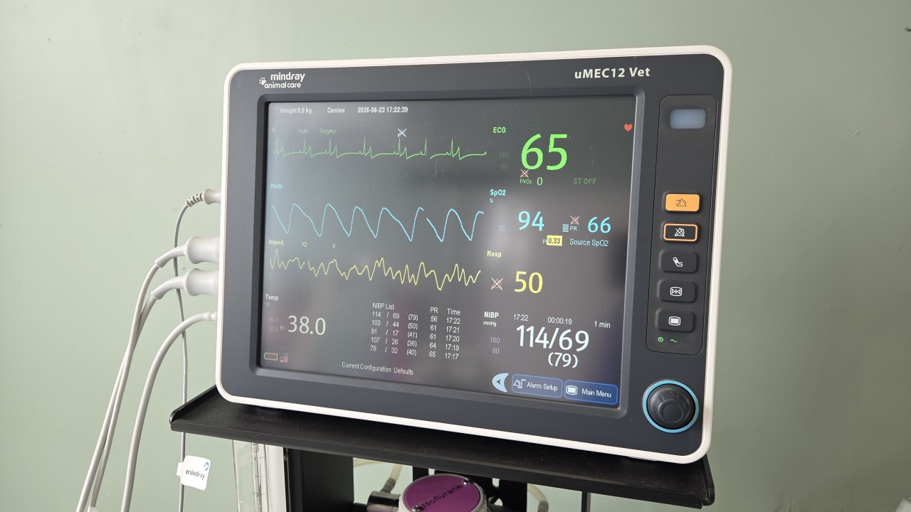 Monitoring d'anesthésie